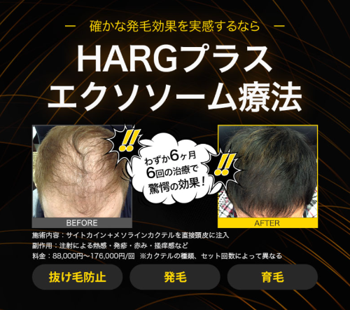 神戸中央クリニックのAGA TOP画像